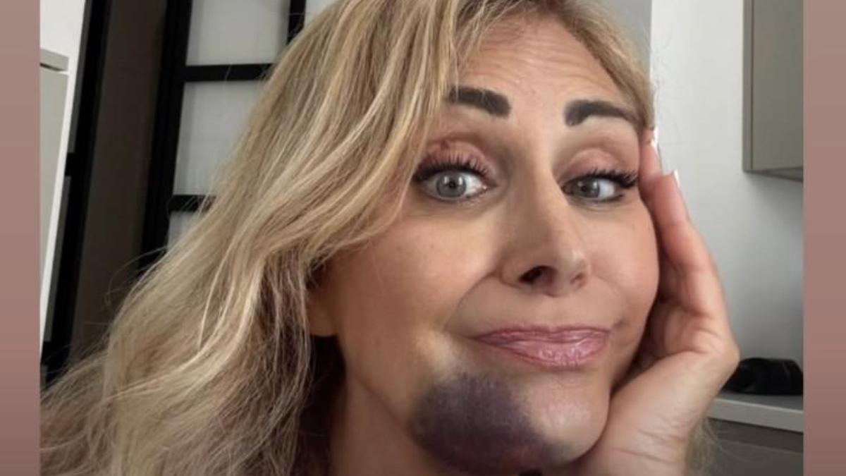 Marina Di Guardo, incidente in auto per la mamma di Chiara Ferragni: “Un trattore è sbucato all’improvviso, poteva andare molto peggio”