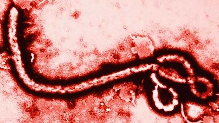 Sospetto Ebola, isolato a Cagliari un paziente rientrato dalla Repubblica Democratica del Congo - la Repubblica