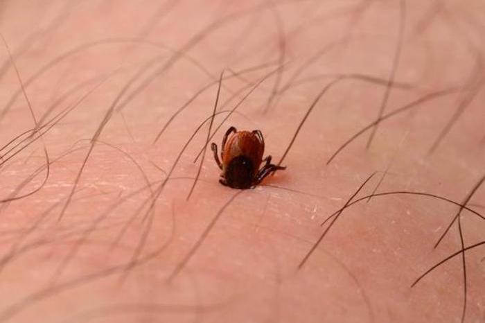 «La Tbe nel 2023 e ora sono invalido al 67%»