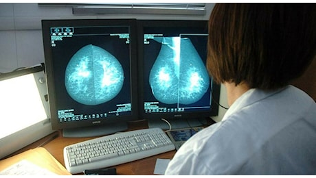 Tumore al seno, a Milano il convegno Breast Cancer in Autumn: focus su diagnosi e terapie