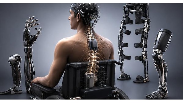 Neuroprotesi sperimentale restituisce movimento e parte del tatto a un uomo con tetraplegia - Mondosanità