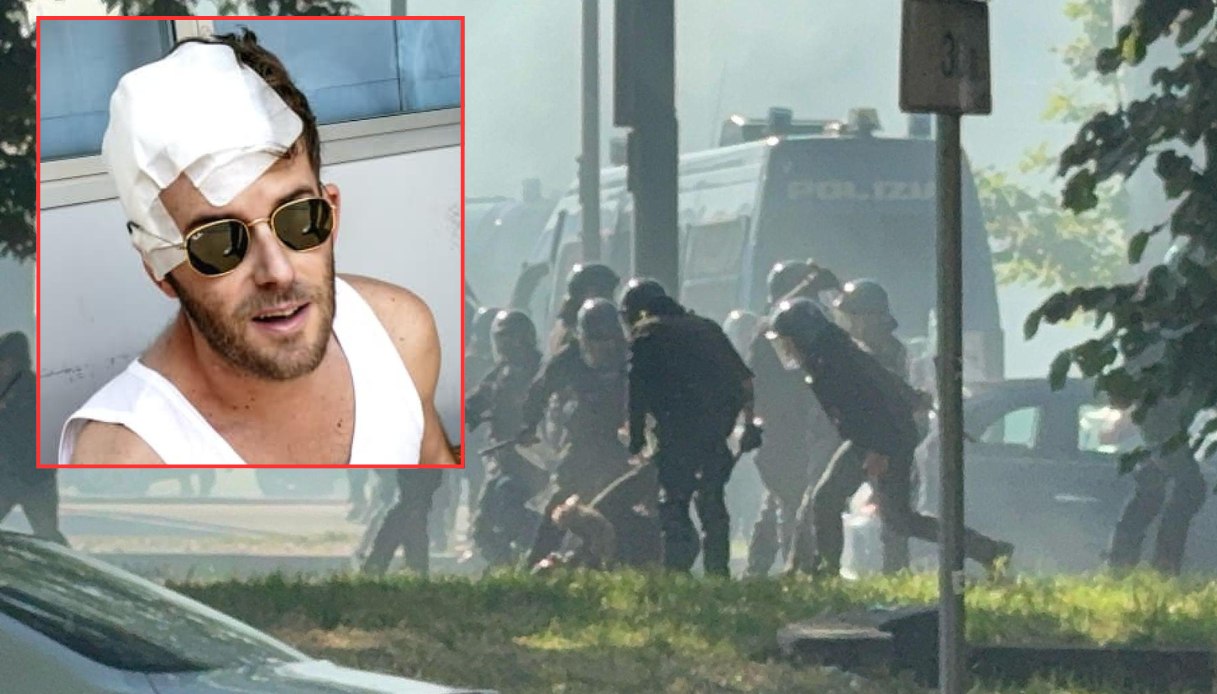 Marco Basoccu ferito prima del derby di Torino, niente arresto per il poliziotto che ha colpito il tifoso