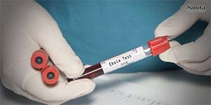Ebola, Oms: Salgono a 1.645 i casi tra Congo, Uganda e Francia