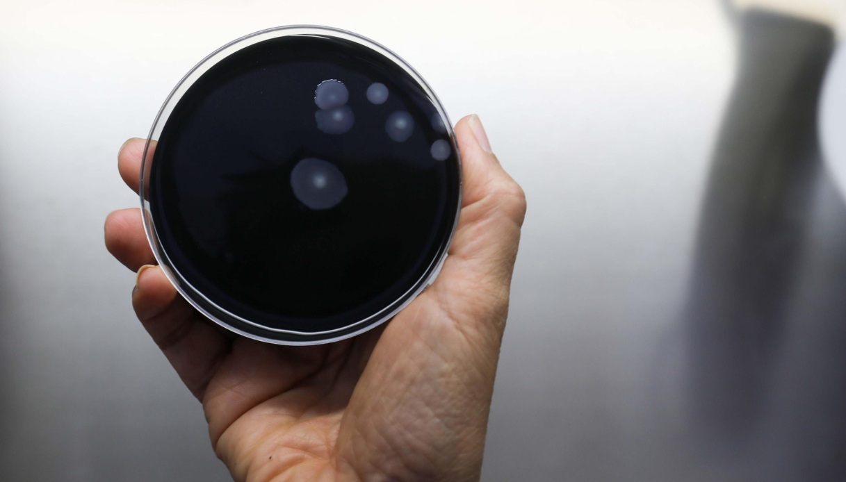Cos'è la legionella, i sintomi e i rischi del batterio che può arrivare in casa attraverso i condizionatori